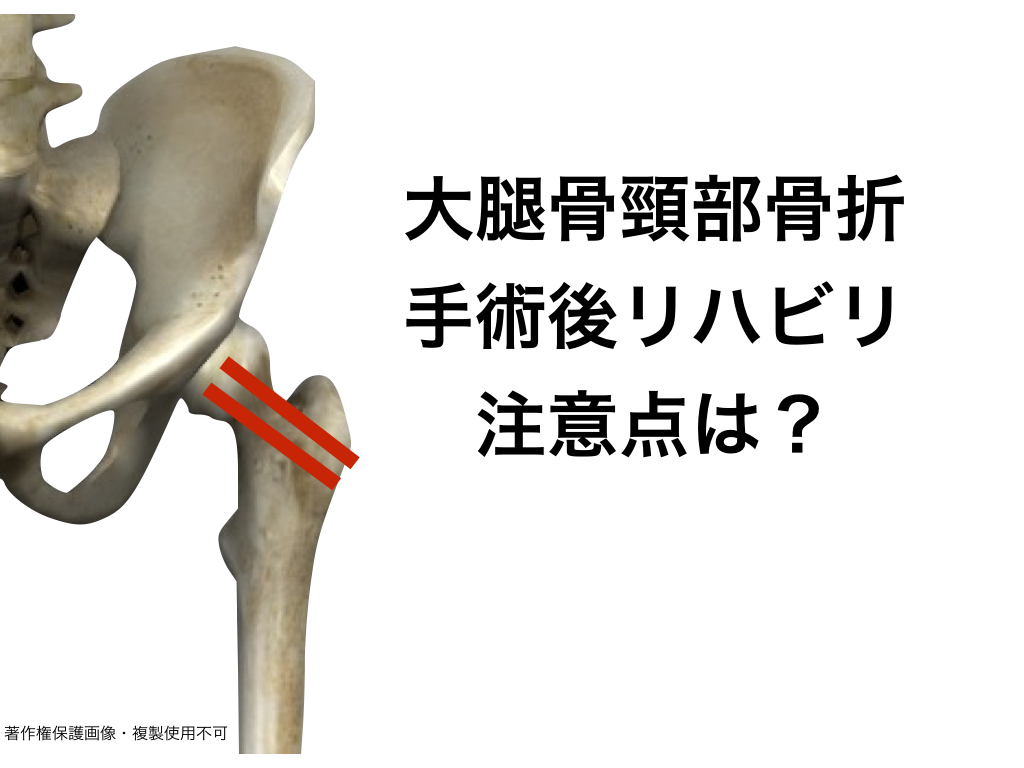 大腿骨頸部／転子部骨折｜最適な看護のため 